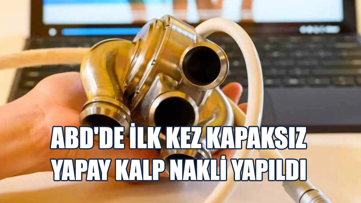 8 Gün Yapay Kalp İle Yaşadı