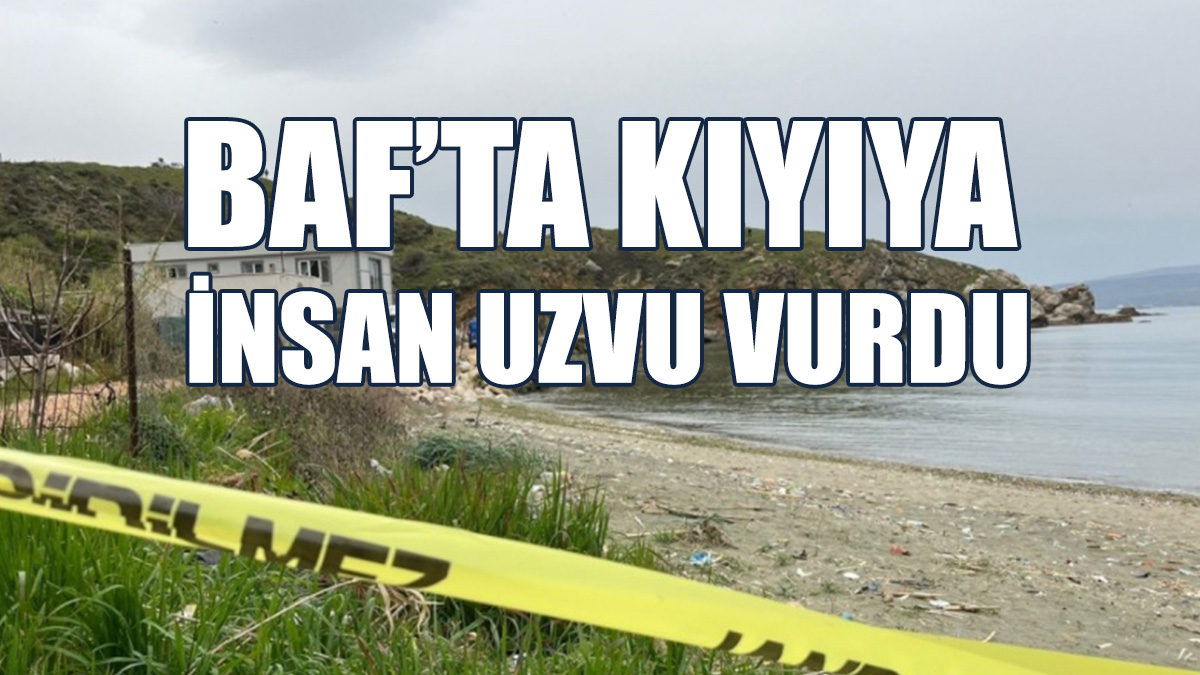 Uzuv, Antropolog Ve Adli Tabip Tarafından İncelenecek