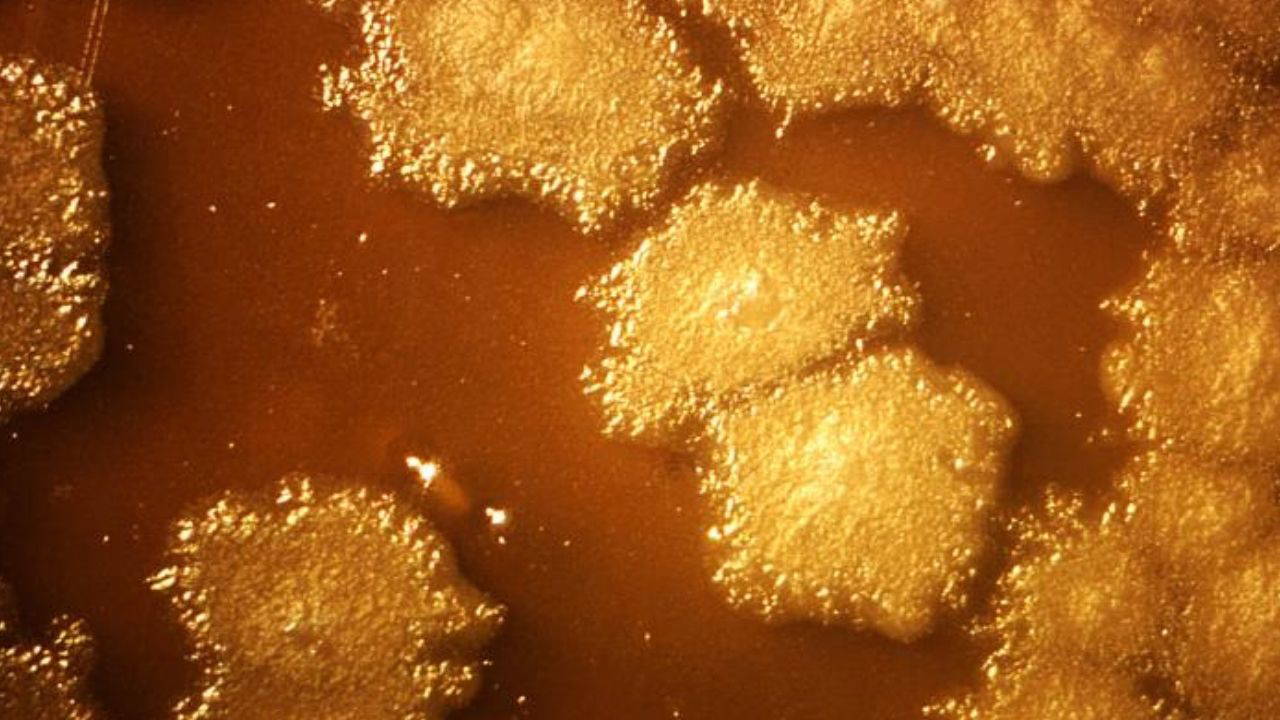 Kanserde çığır açan gelişme…  'Akıllı' bakteriler geliştirildi