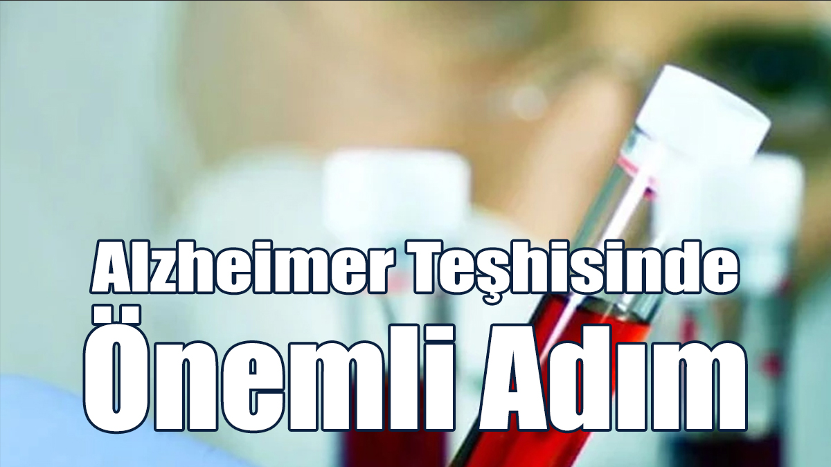 Alzheimer Teşhisinde Önemli Adım