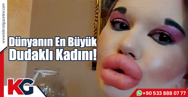 Dünyanın En Büyük Dudaklı Kadını!