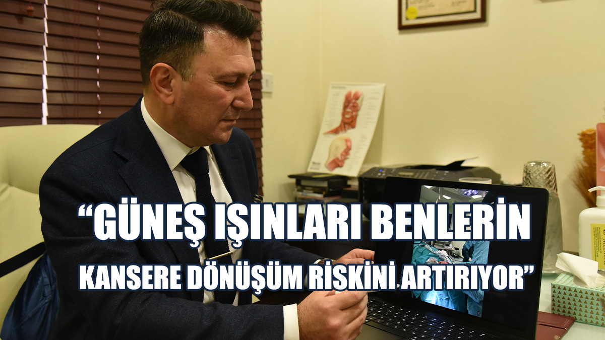 “Lazer İle Ben Alma İşlemi, Benlerin Kansere Dönüşme Riskini Artırabilir”