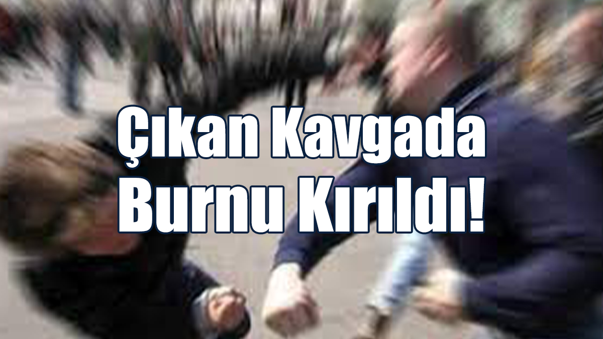 Çıkan Kavgada Burnu Kırıldı!