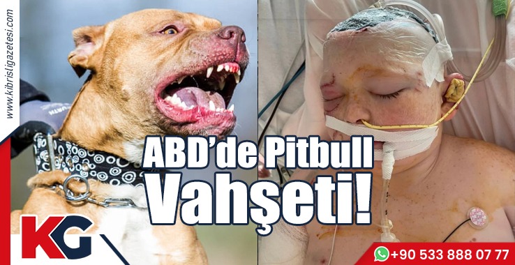 ABD'de Pitbull Vahşeti!