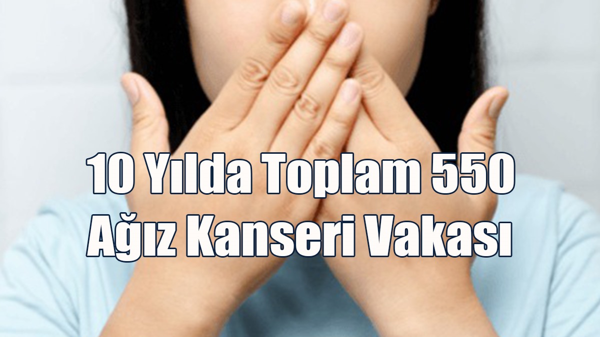 Güney Kıbrıs’ta Son 10 Yılda Toplam 550 Ağız Kanseri Vakası Kayda Geçirildi