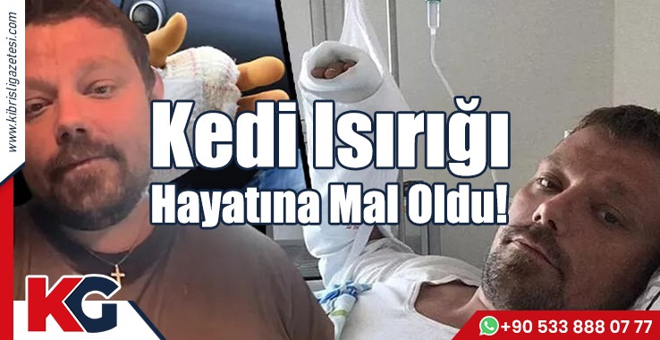 Kedi Isırığı Hayatına Mal Oldu!