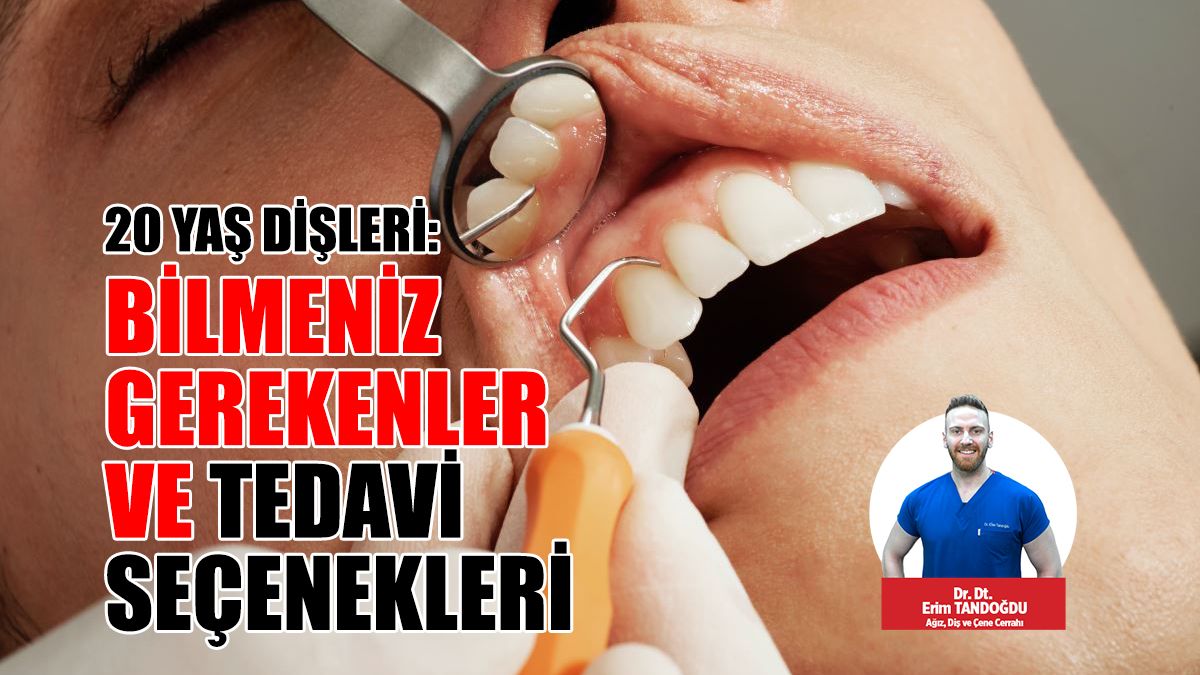 20 Yaş Dişleri: Bilmeniz Gerekenler ve Tedavi Seçenekleri