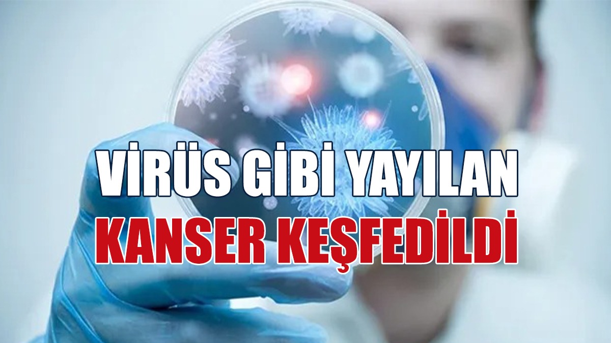 Virüs Gibi Yayılan Kanser Keşfedildi