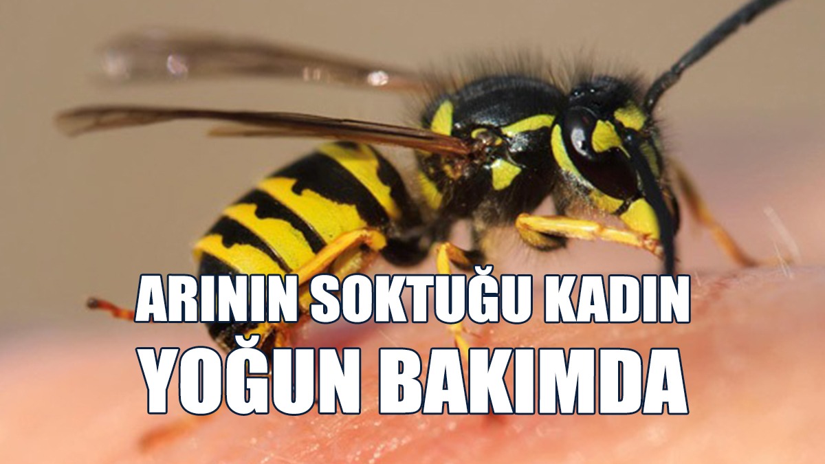 Ağılda Arının Soktuğu Kadın Rahatsızlandı