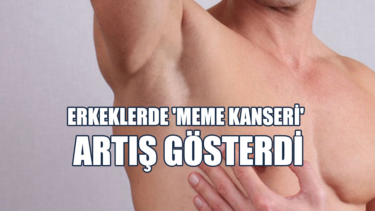 Erkeklerde 'Meme Kanseri'  Artış Gösterdi