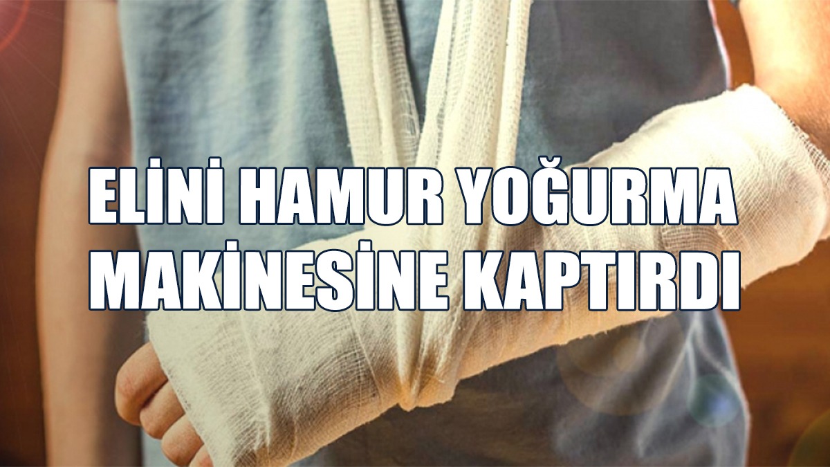 20 Yaşındaki Çalışanın Eli Kırıldı