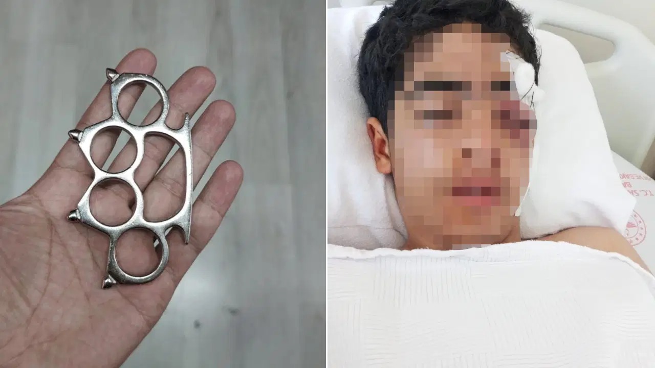 İstanbul’da 15 yaşındaki çocuğa akranından muştalı saldırı!