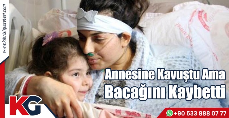 Annesine Kavuştu Ama Bacağını Kaybetti